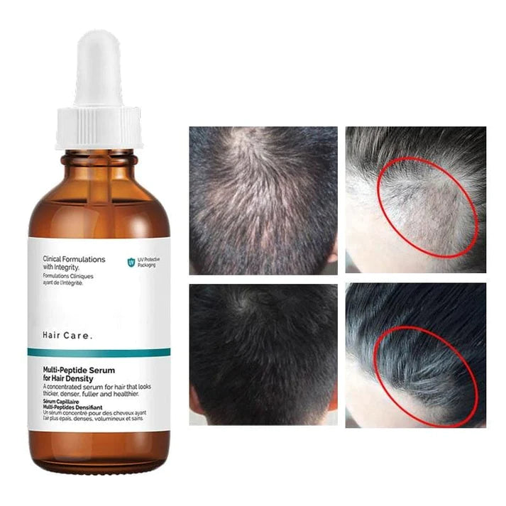 Serum profesional para la caída del cabello